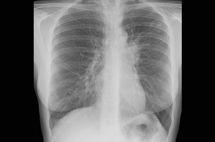 radiologie.jpg radiologie.jpg