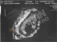 CancanIata ecografia Oanei Zavoranu! A fost la medic in urma cu o saptamana