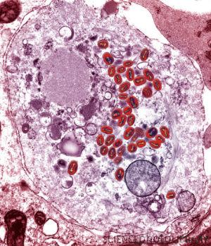 c0052674-smallpox_or_variola_virus__tem-spl.jpg
