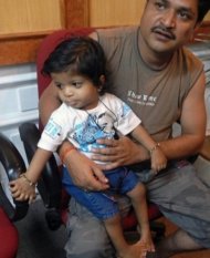 Incredibil! Un băieţel din India cu 34 de degete