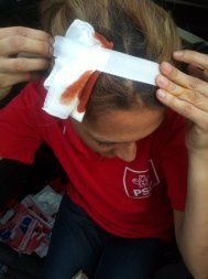 Incidente violente în ultima zi de campanie Un lider PSD s-a ales cu capul spart     