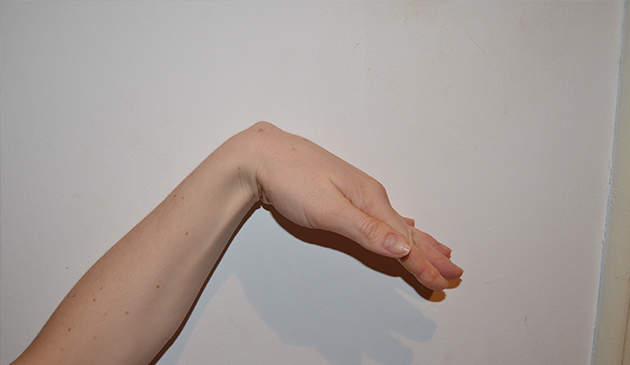 dureri articulare sinoviale pe deget