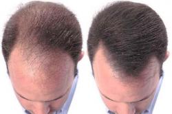 voceaconstantei.roAlternativa la produsele din comerț. Remedii naturiste pentru stoparea căderii părului 