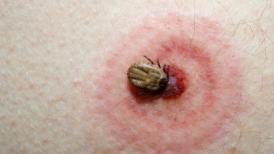 voceaconstantei.ro Înțepăturile de insecte – periculoase sau nu?!