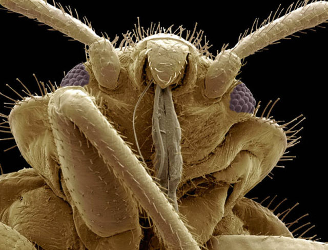 insectele vazute la microscop sunt uluitoare galerie foto 577807