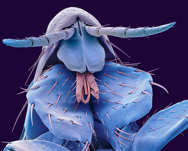 insectele vazute la microscop sunt uluitoare galerie foto 577807