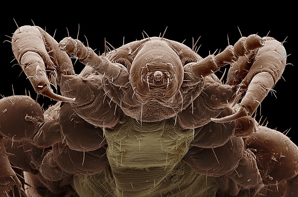 insectele vazute la microscop sunt uluitoare galerie foto 577807