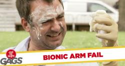 Funny video Mână prostetică ieşită din control