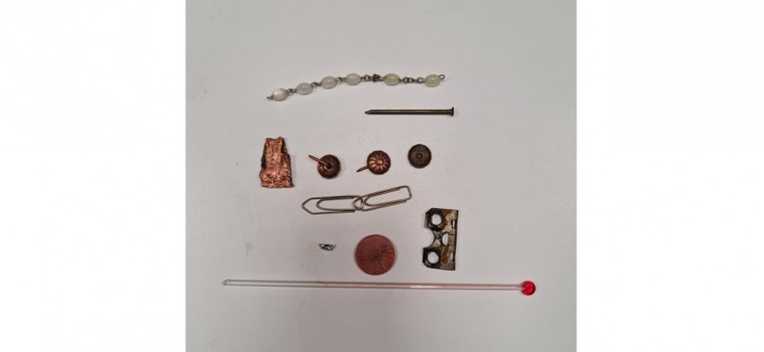 Obiecte ingerate de un pacient. Foto: Spitalul Județean Suceava