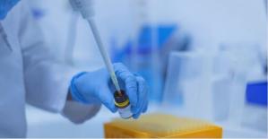 Variola maimuţei Primul deces în afara Africii, înregistrat în Brazilia