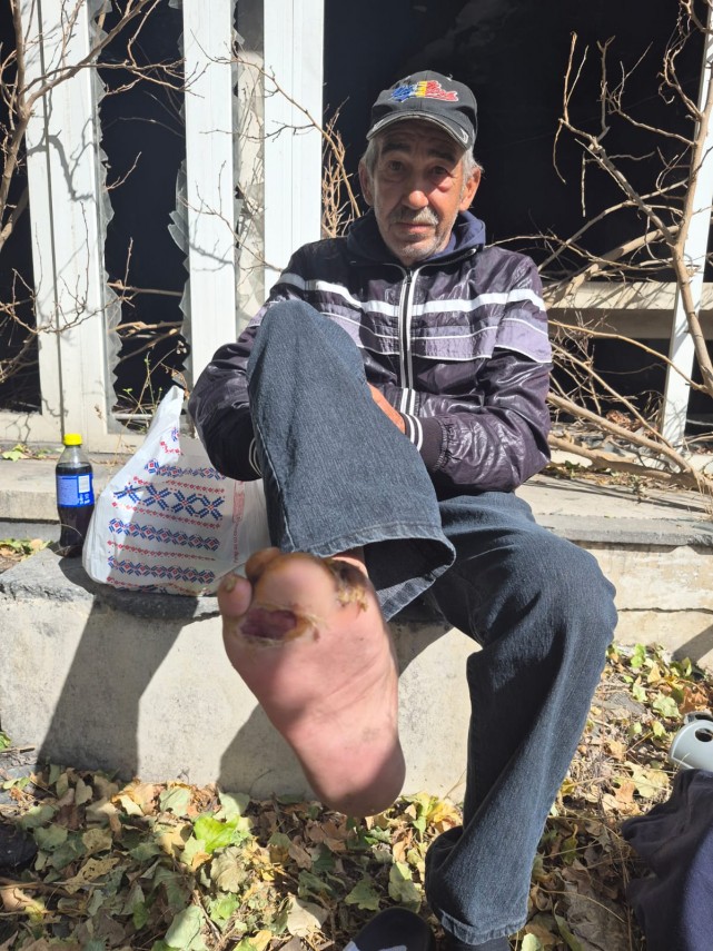 arimex comexim 2000 srl foto drama unui fost gardian din navodari bolnav fara locuinta si cu rani grave arimex comexim 2000 srl foto drama unui fost gardian din navodari bolnav fara locuinta si cu rani grave
