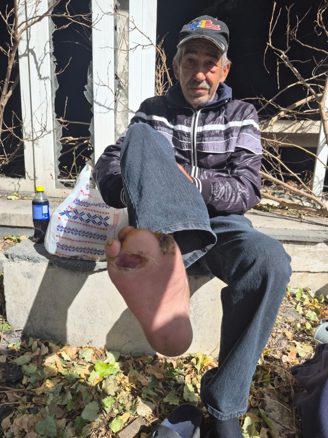 arimex comexim 2000 srl foto drama unui fost gardian din navodari bolnav fara locuinta si cu rani grave arimex comexim 2000 srl foto drama unui fost gardian din navodari bolnav fara locuinta si cu rani grave
