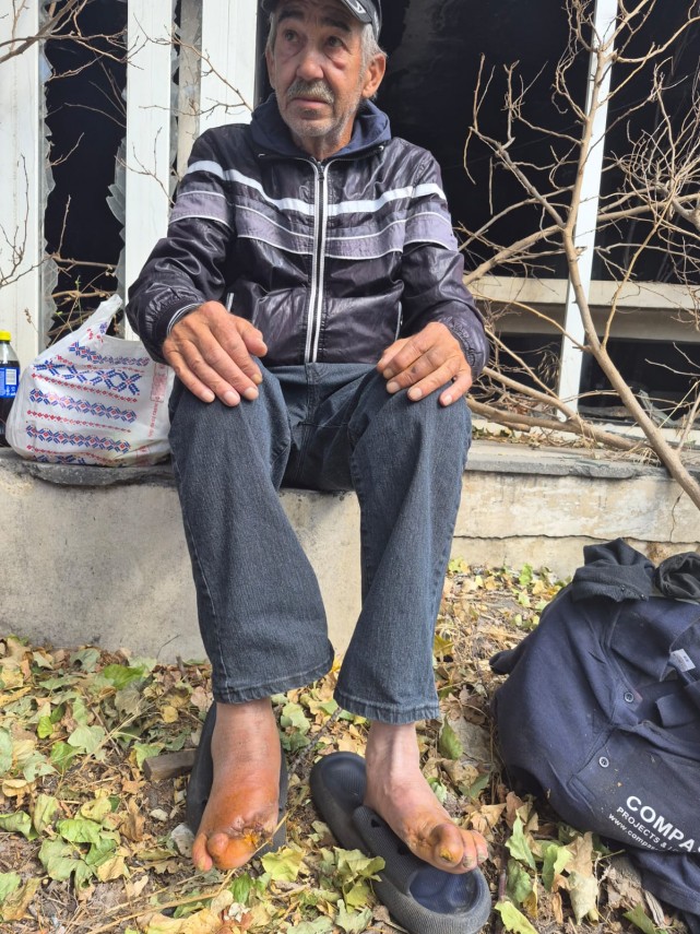 arimex comexim 2000 srl foto drama unui fost gardian din navodari bolnav fara locuinta si cu rani grave arimex comexim 2000 srl foto drama unui fost gardian din navodari bolnav fara locuinta si cu rani grave
